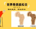 如何预防骨质疏松？