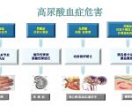 高危高尿酸血症
