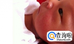 湿疹皮肤为什么会发红