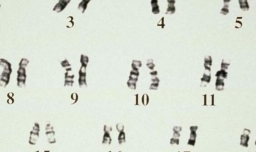 如何判断遗传病的类型
