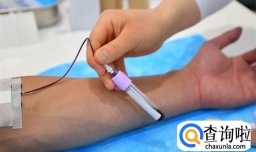 碱性磷酸酶偏高是什么意思