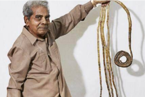 世界上最长的指甲