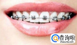 自锁牙套第五次复诊，带牙套掉了托槽怎么办？