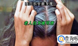 头发变白或因干细胞“卡住”了 头发变白的原因