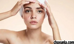 去除痘痘的方法