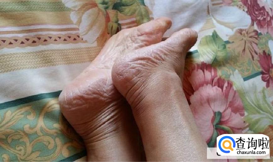 脚后跟干裂如何保养及护理