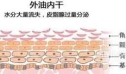 改善肌肤出油问题的方法