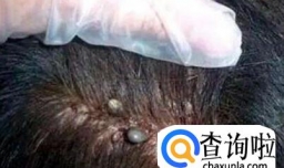 感觉身上有虫子爬是怎么回事？怎么治疗？