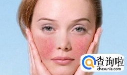 面部有红血丝，在日常中要怎么护理呢？