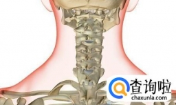 颈椎生理曲度变直严重吗
