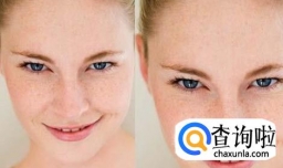 雀斑可以根治的道理，百姓用亲身经历告诉你！