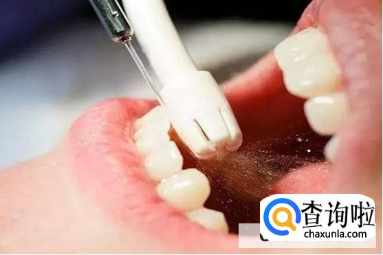 洗牙后使用电动牙刷好吗