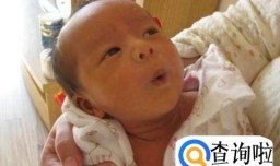 怎样给婴儿去黄胆