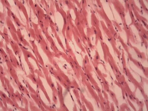 为什么有的肌肉不休息