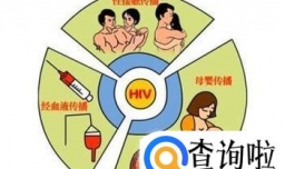 艾滋病家属应该注意哪些方面