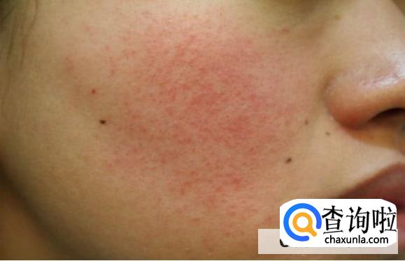 使用护肤品会影响身体吗