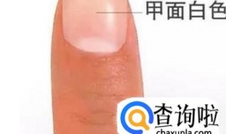根据指甲判断身体健康状况