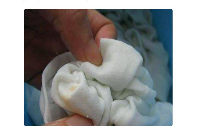 白色衣服有黑色斑点怎么洗净