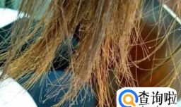 女性气血不足有哪些表现？