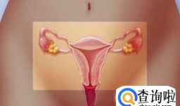 女性出现宫外孕有哪些危害？