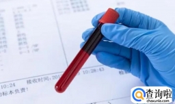 诺如病毒是啥怎么防治怎么检测