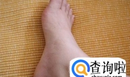 来月经之前有哪些症状