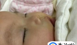 新生儿鼻子上为什么有白点