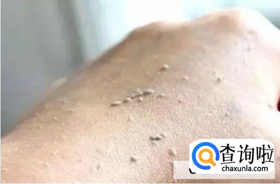 为什么天天洗澡，身体还是会搓出泥呢