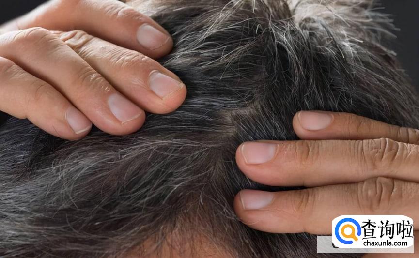 头发花白应该吃什么食物