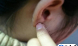 耳洞臭臭的怎么清洁