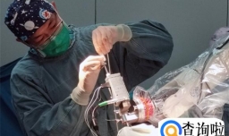 机器人辅助帕金森脑深部电刺激器植入手术