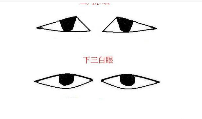 什么是三白眼