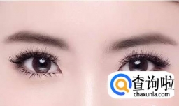 如何长出自然双眼皮