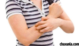 产后皮肤瘙痒多久会好