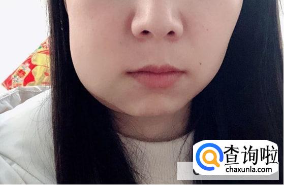 拔智齿会掉智商还能瘦脸