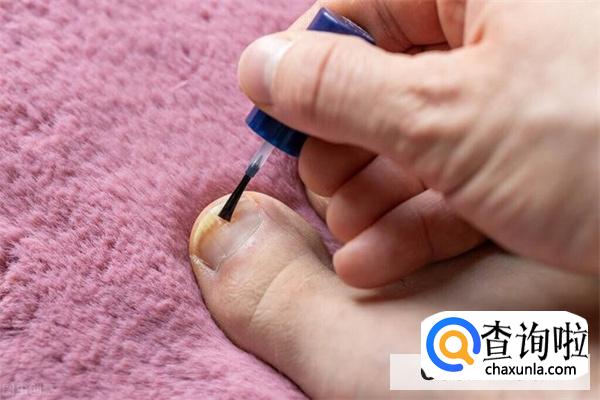 指甲往肉下面长要用选哪种指甲钳好