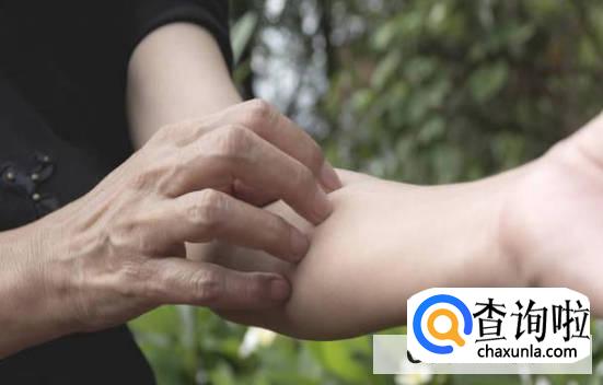 毛囊炎产生的原因是什么