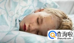 如何快速判断孩子猩红热经验浅谈