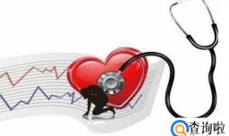 心脏骤停的定义是什么