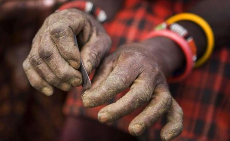 割礼是什么意思