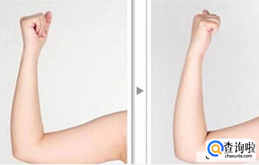 手臂粗大有哪些原因