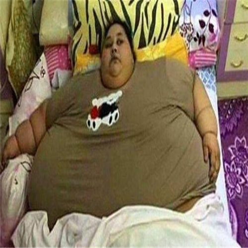 世界最胖的女人