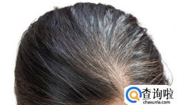 白头发会越拔越多吗