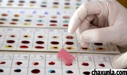 做亲子鉴定对孩子有伤害吗