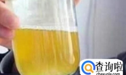 身体缺水的十大信号，你知道几个？