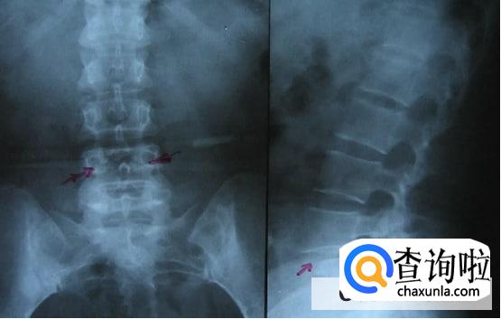 睡醒时腰酸背痛的原因