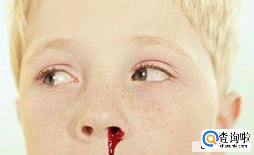 为什么会流鼻血,流鼻血的原因