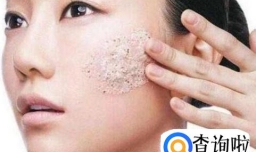 如何去除脸上的螨虫