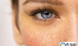 肝不好真的会变丑吗