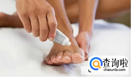 脚臭有时令人很尴尬怎么处理